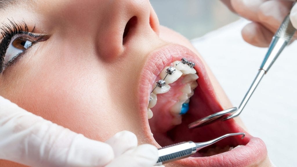 Orthodontic treatment secrets