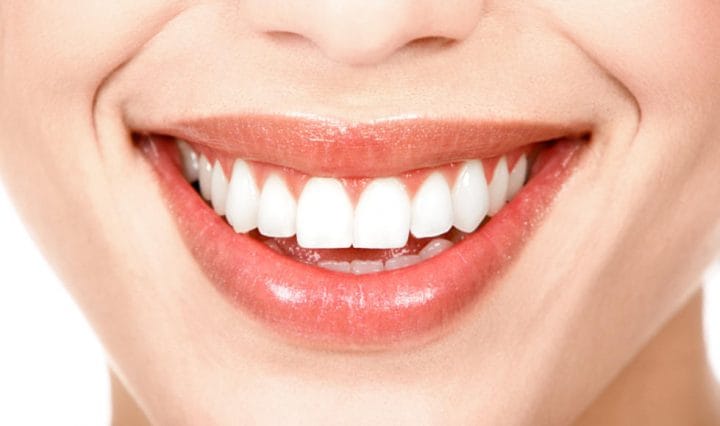 White Teeth Home