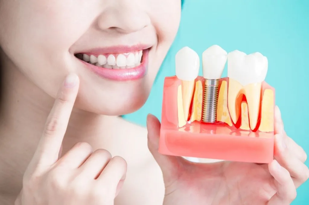 How much do teeth implants cost
