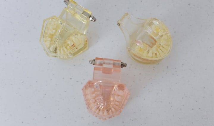 Invisalign Braces