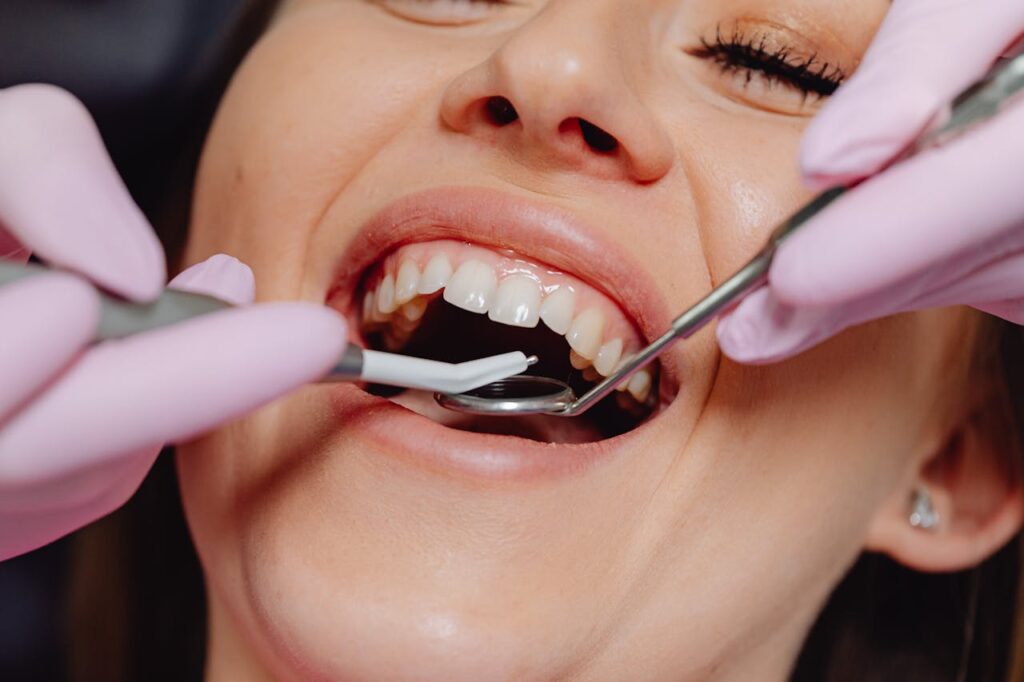 Hollywood smile treatment